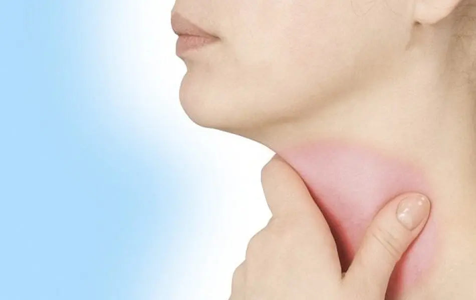 How contagious is strep throat?